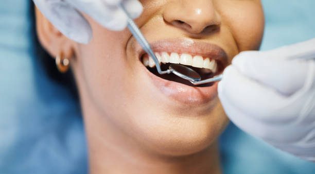 Best Weekend Emergency Dentist in Ellitt, CO