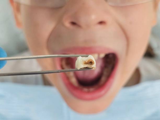 Best Walk-In Emergency Dentist in Ellitt, CO